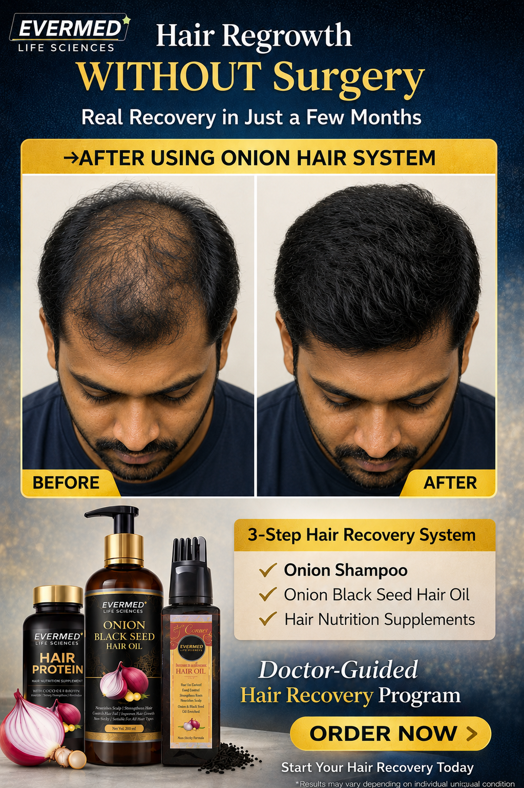 Evermed 3-Step Hair Recovery Combo